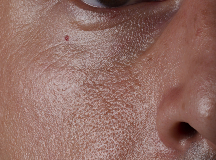 Eye and cheek detail